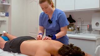 ASMR Back Acupuncture ✨ Real Person Treatment for Deep Relaxation & Sleep