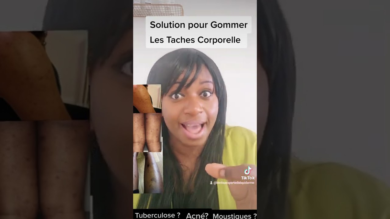 Solution pour Gommer les Taches noires au niveau du corps