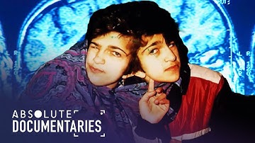 The Incredible Separation: The Conjoined Twins