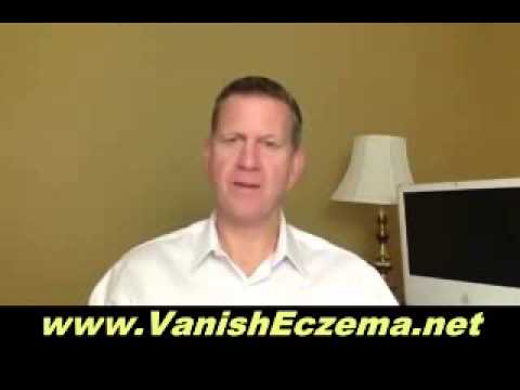 Heal Yourself Naturally With An Eczema Diet 