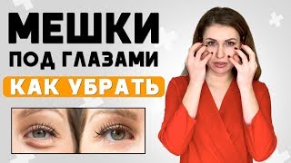 Как убрать МЕШКИ под ГЛАЗАМИ. Топ методов и средств. Причины появления грыж