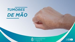 Tumores de Mão: o que são, tipos e como tratar | Dr. Fernando Moya CRM 112.046