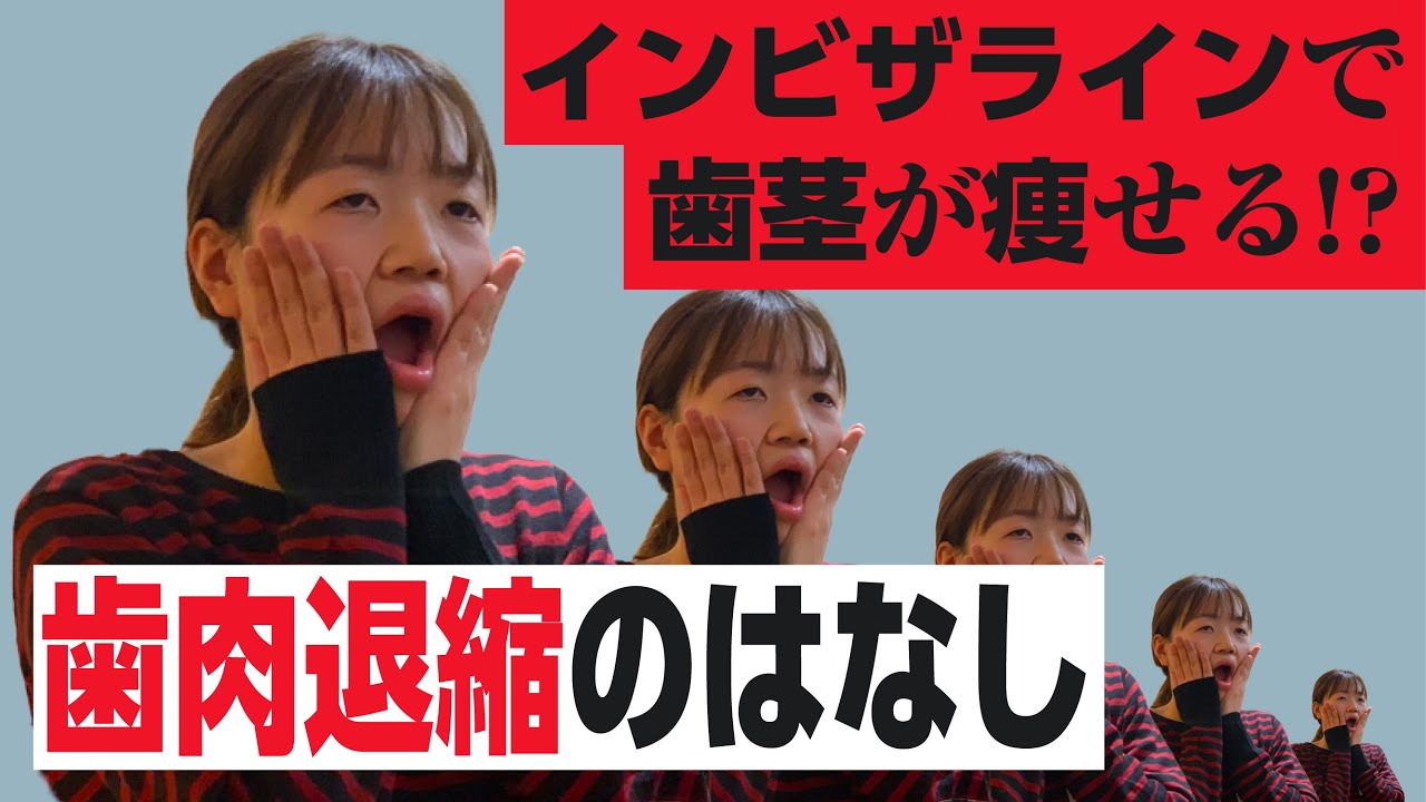 矯正で歯茎が痩せる！歯肉退縮の話。