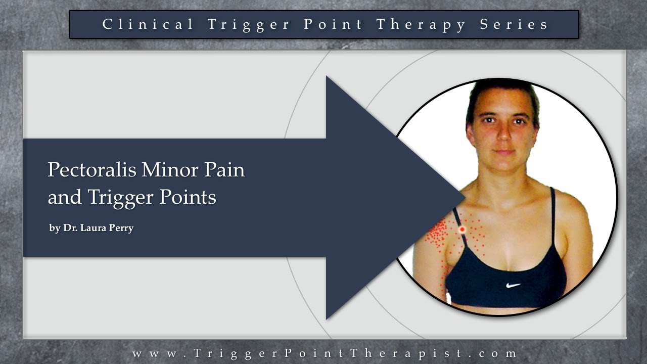 Pectoralis Minor Pain and Trigger Point - YouTube