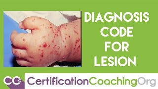 Understanding Diagnosis Code for Lesions in the 10000 Series