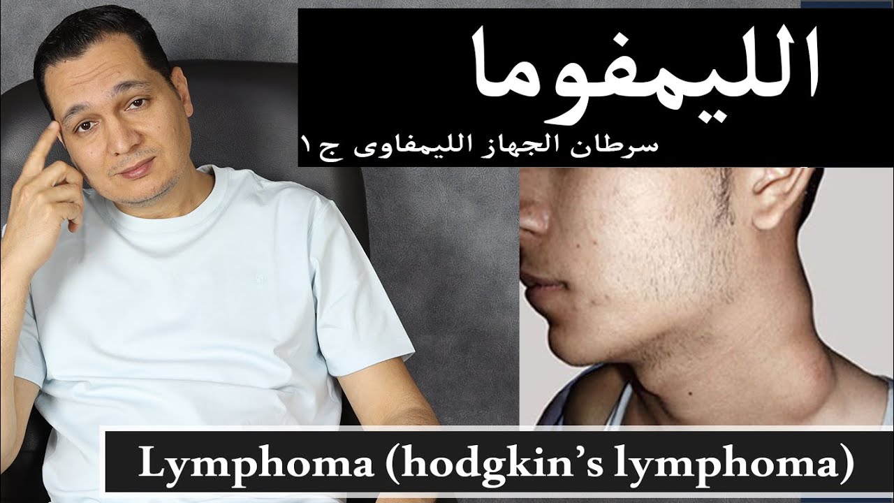 الليمفوما - الجزء الاول/ lymphoma and hodgkin's lymphoma