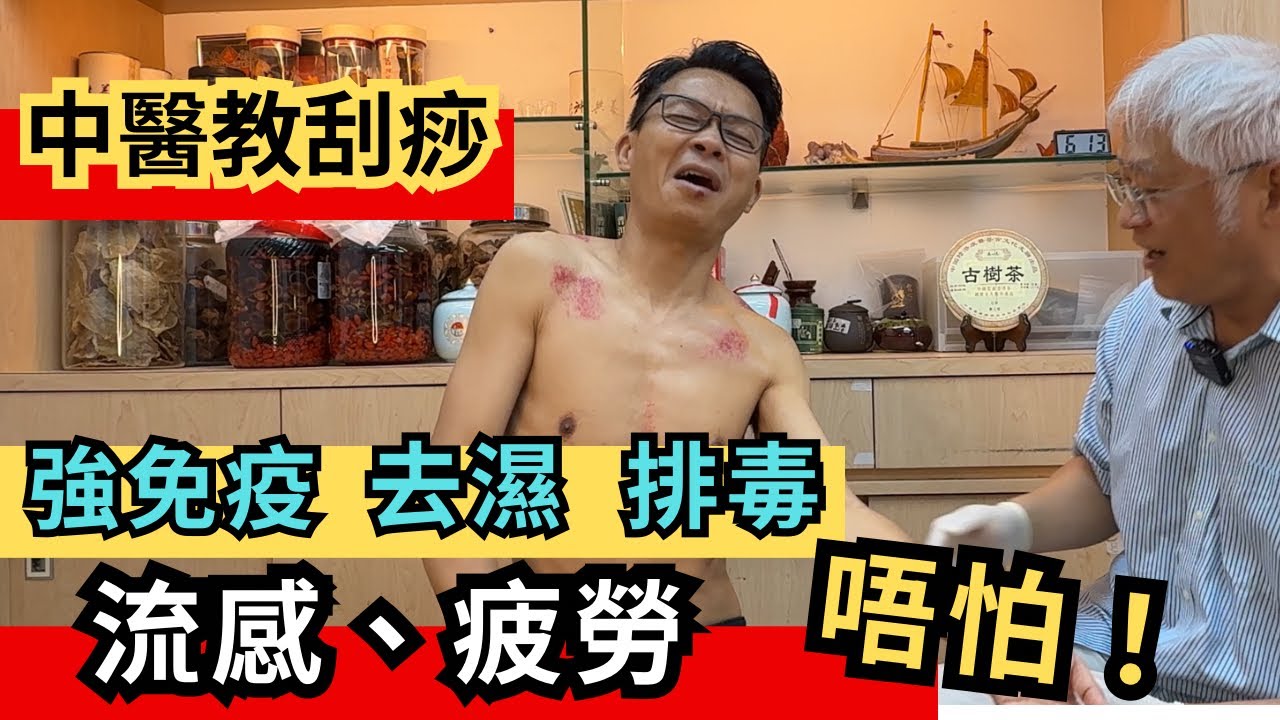 有病自救不求人。中醫師教你正確刮痧，通經絡•百病除•增強免疫💪🏻流感新冠，唔使怕！#刮痧  #傷風感冒 #新冠肺炎  #covid19  #新冠病毒 #流感 #去濕排毒
