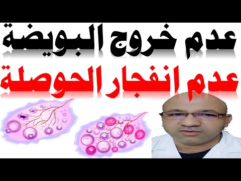 عدم خروج البويضة أو عدم انفجار الحوصلة ايام التبويض و تأخر الحمل