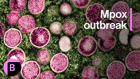 Mpox Outbreak: Here