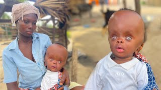 Transforming Four Months Old Babys Life A Journey Of Hope