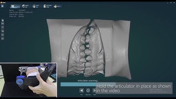 how to scan virtual occlusion with UP360+