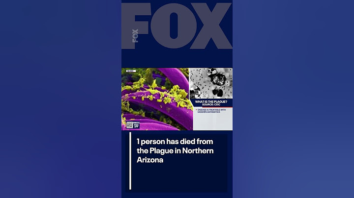 Person dies from the Plague in Northern Arizona | FOX 10 Phoenix