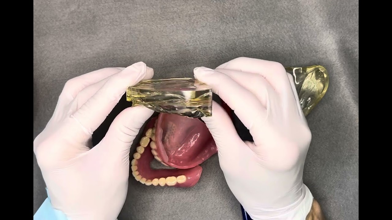 5分解説@入れ歯には脱離しにくい重心がある