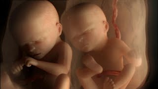 जीवन की अद्भुतता: गर्भाशय में जुड़वां शिशुओं का निर्माण देखें 🤰👶✨