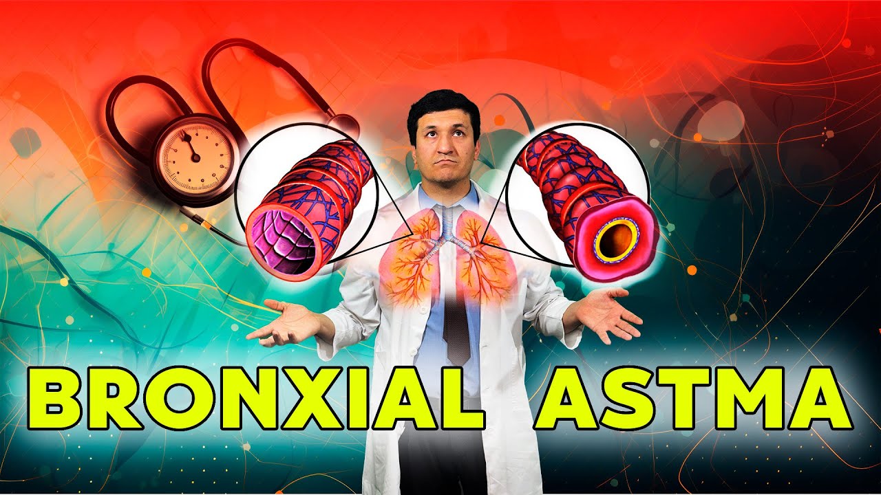 Bronxial astma xuruji sabablari(12-savol)Бронхиал астма хуружи сабаблари