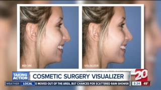 Dr. Mark Berkowitz Discussing the Cosmetic Surgery Visualizer with ABC News
