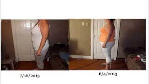 Gastric Bypass 8 month post op