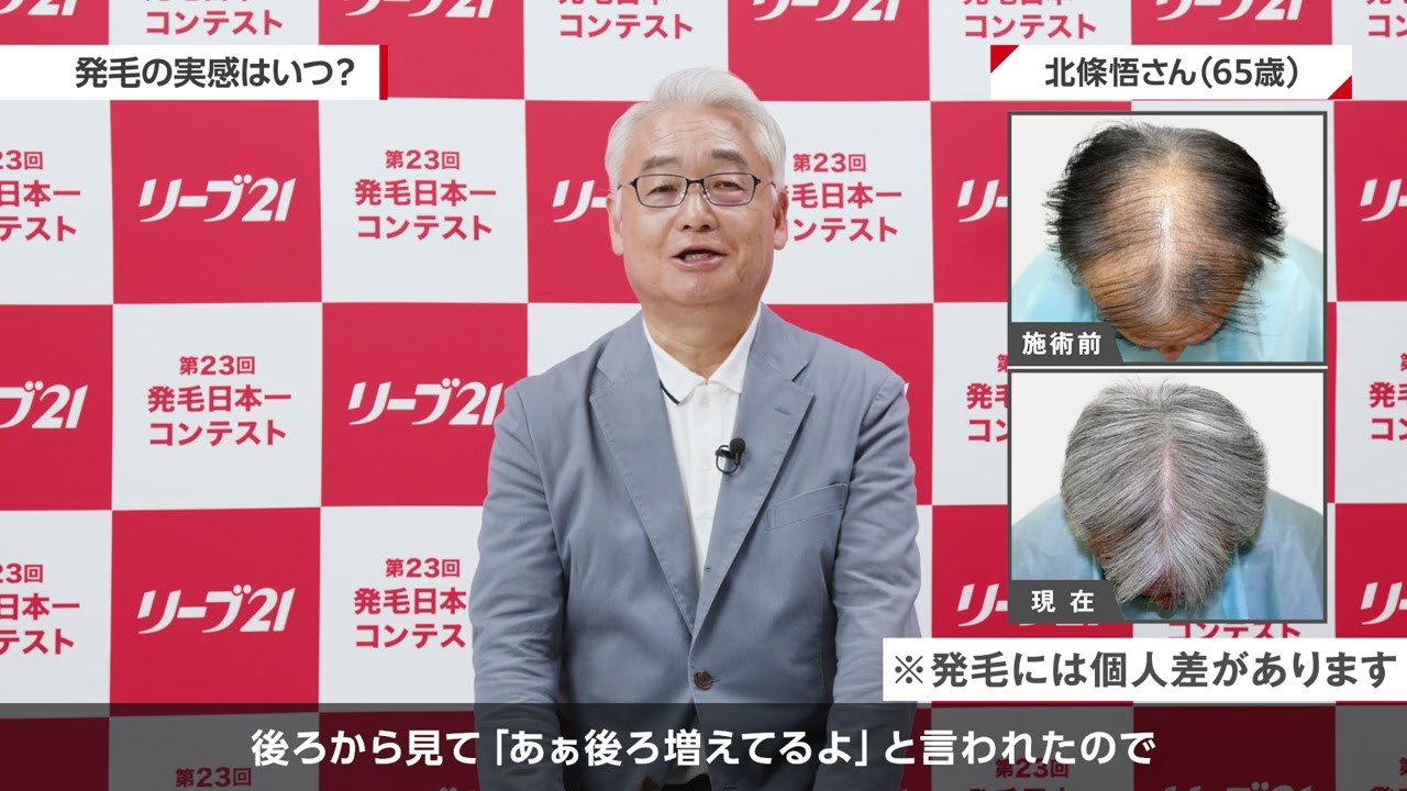 リーブ21発毛 体験者の声