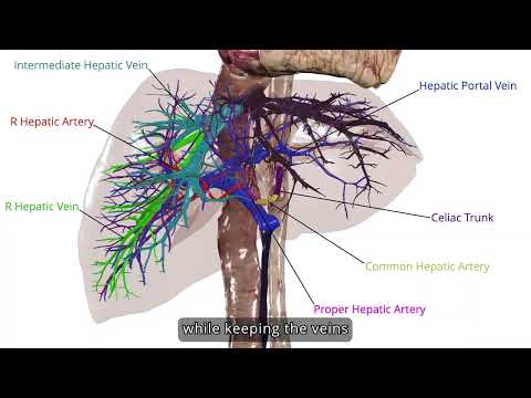 Inside Liver Transplant Surgery: Hepatectomy Anatomy Explained | Anatomage
