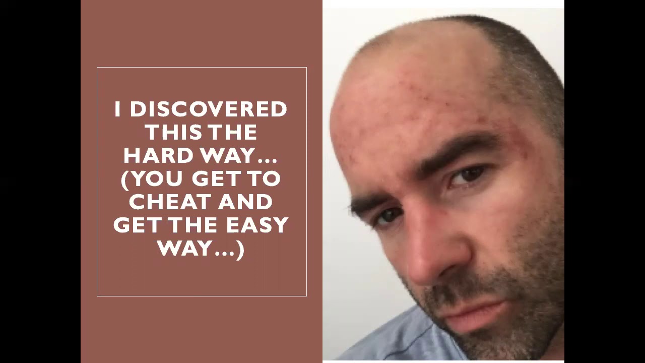 How I Reversed My Eczema And Helped Others Do The Same With A Variety