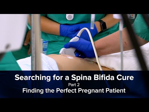 Video: Spina Bifida