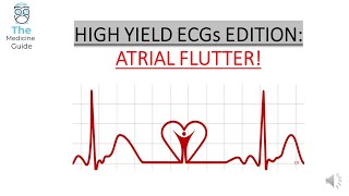 HIGH YIELD ECGs EDITION: ATRIAL FLUTTER!