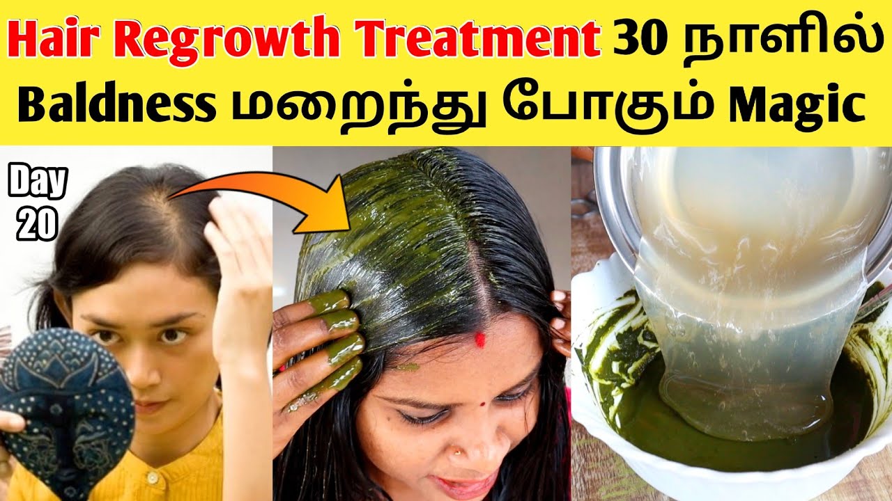 😍 30 நாளில் Baldness மறைந்து போகும் Magic Hair Regrowth Treatment / 30 days challenge / hair pack 7