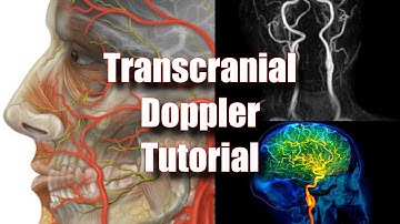 Transcranial Doppler: Tecnique, Anatomy & Protocol