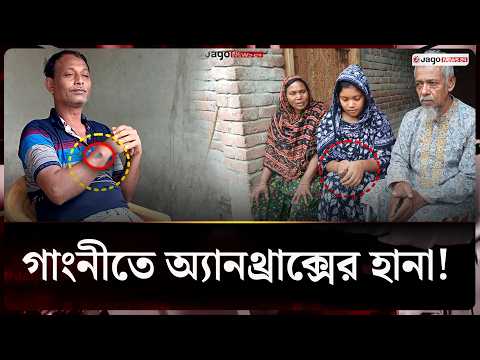 Blisters on Hands After Touching Meat: Anthrax Cases Surge in Meherpur | Anthrax | Jago News