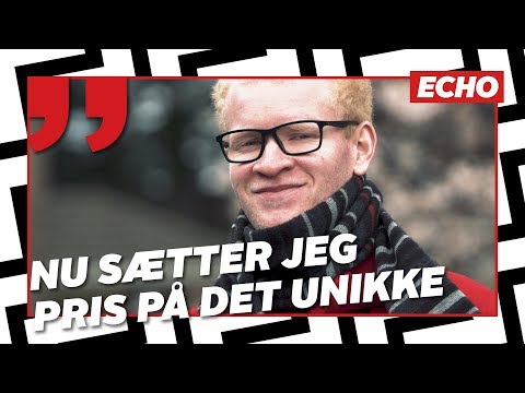 Video: Et Sort Par Havde En Hvid Pige, Og Dette Er Ikke En Albino - Alternativ Visning