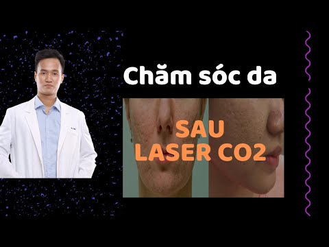 LASER CO2 – TRỊ SẸO – Hướng dẫn chăm sóc da ĐÚNG CÁCH sau Laser Co2 Fractional | Dr Hiếu