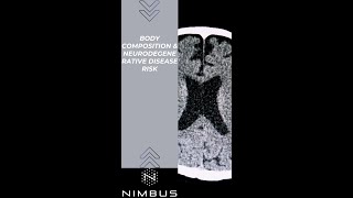 A Link Between Body Composition And Neurodegenerative Diseases