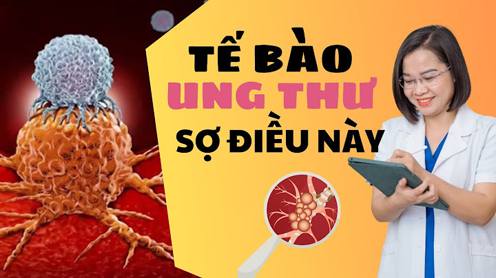 Các bài tập thể dục tốt cho thận