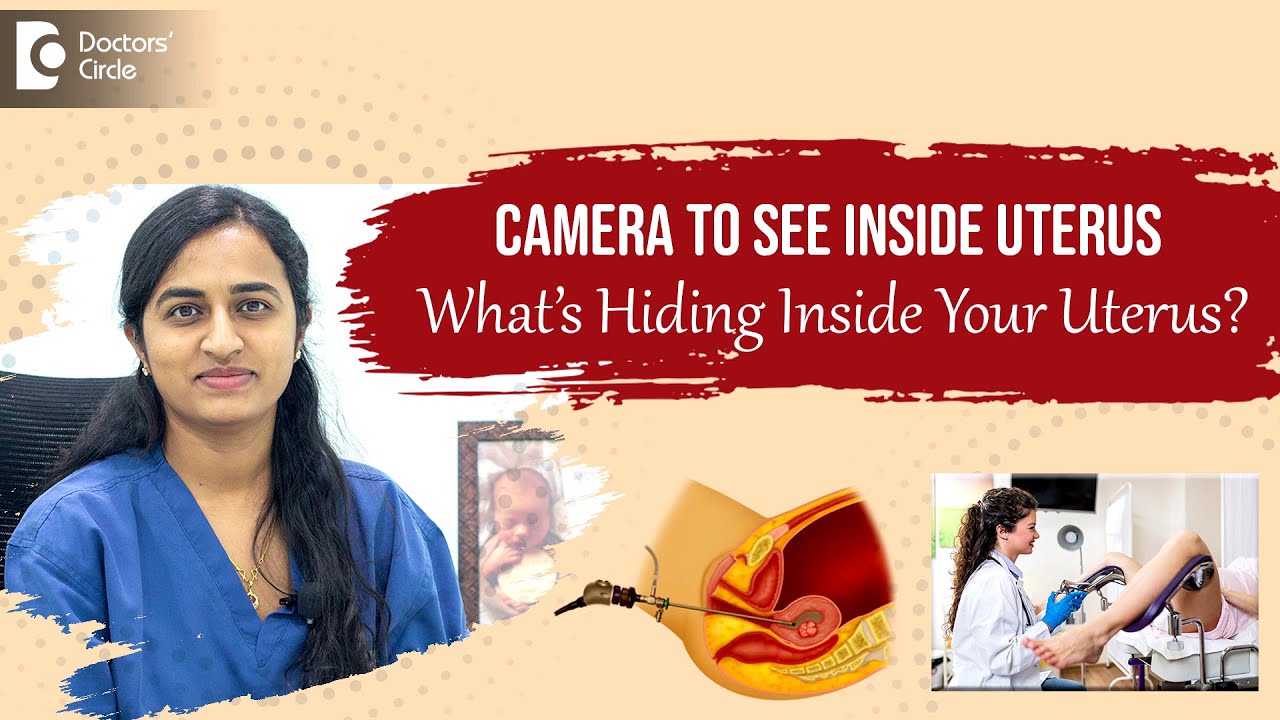 Camera Inside Your Uterus to Diagnose Hidden Issues | Hysteroscopy -Dr ...