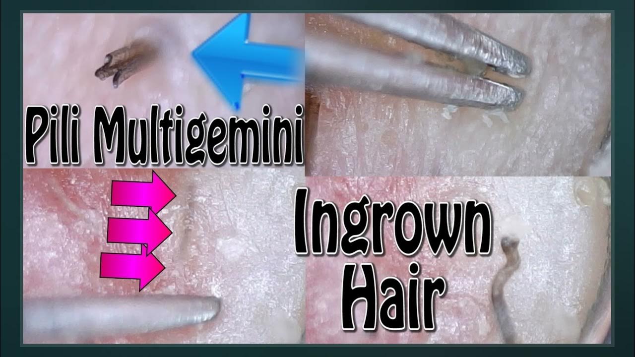 Pili Multigemini YouTube