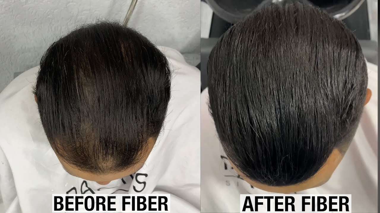 From thinning hair to full thick looking hair. Before & After Look