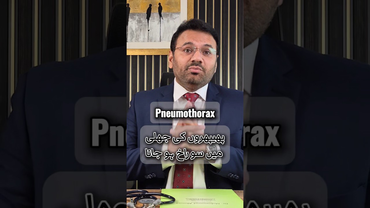 Warning Signs of Pneumothorax – Don’t Take Chest Pain Lightly! 