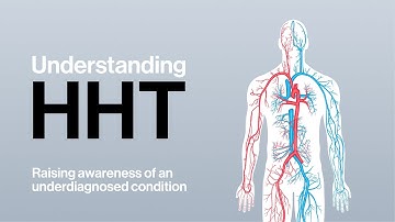 Understanding HHT – Motion Graphics Explainer Video