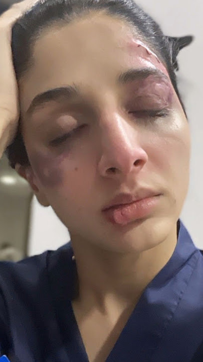 Injured 🩸 Mawra huccain ♥️🥺#share #like #comment