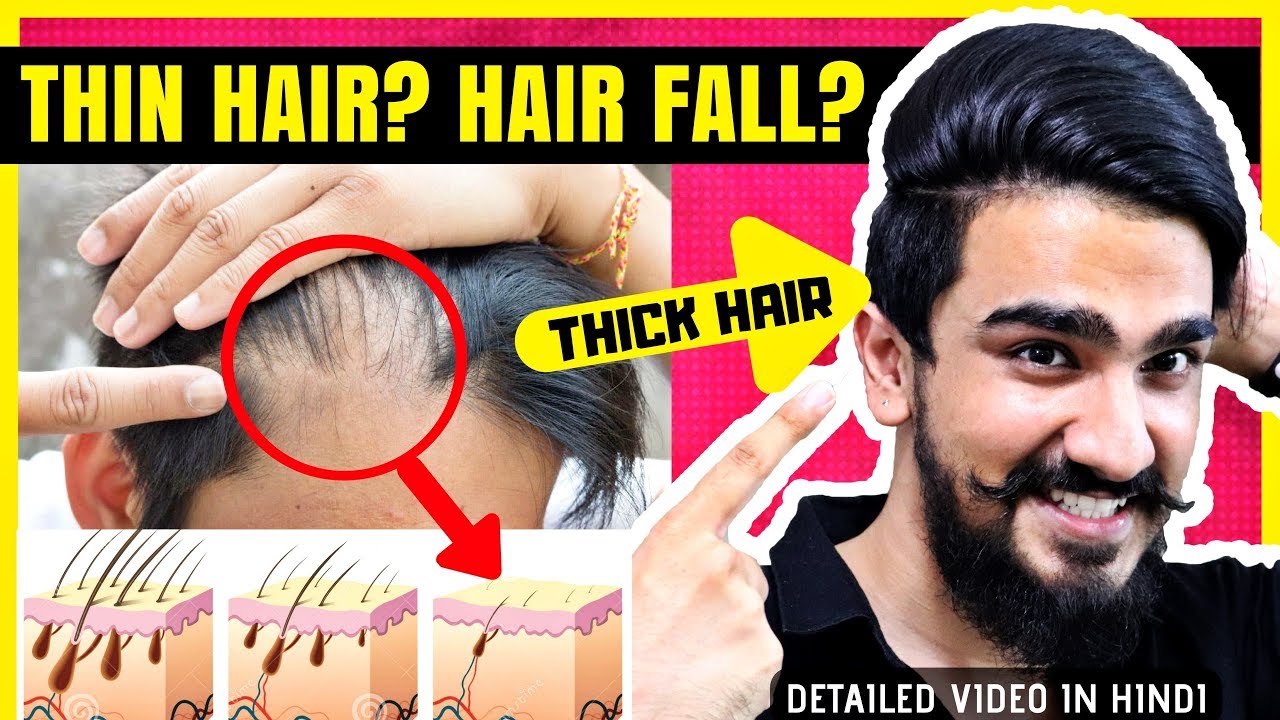 How to get Thicker Hair Naturally for Men | in Hindi | Hair Thinning Men  Treatment - YouTube