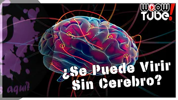 ¿Puede una persona vivir sin cerebro?