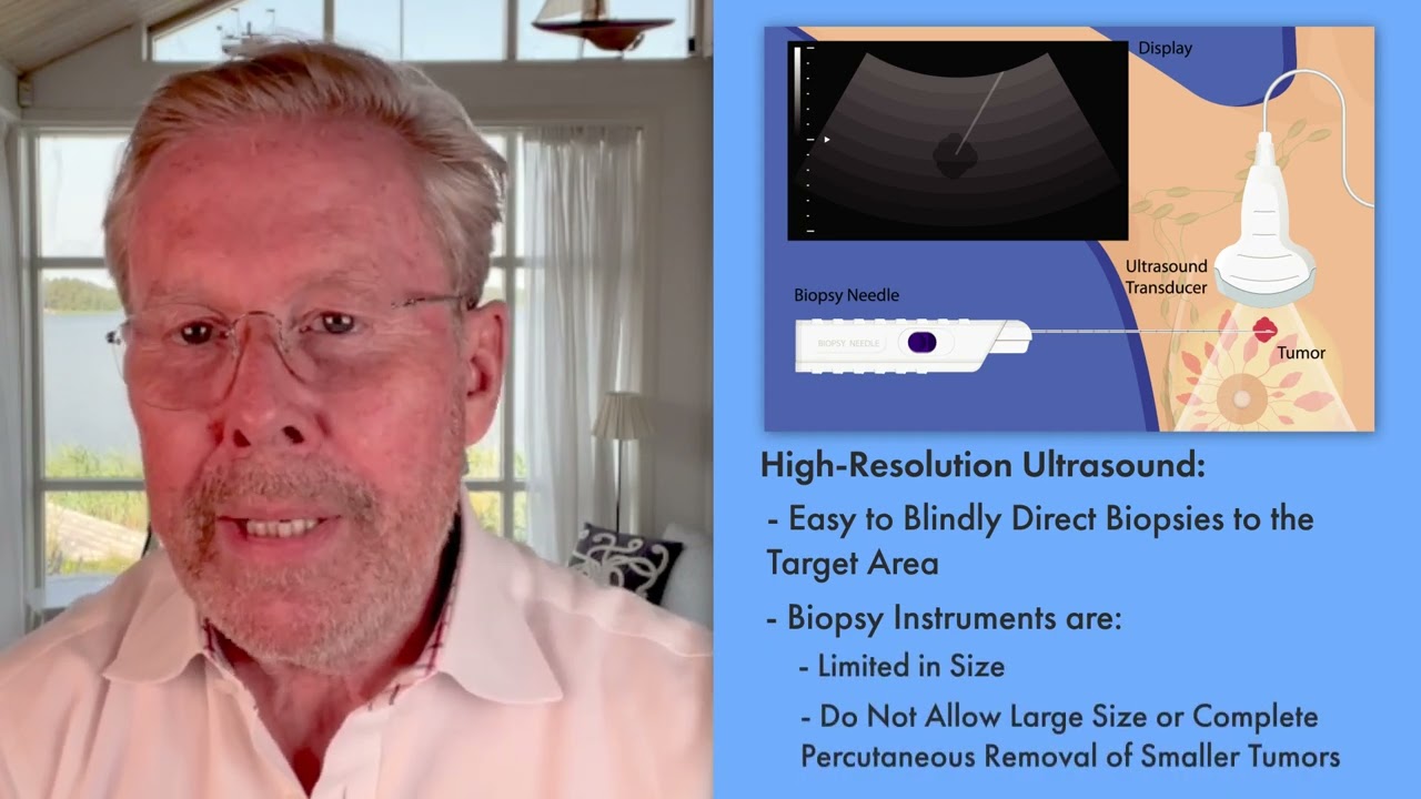 Face the Case: Biopsy Results Are Not Sufficient to Exclude BIA-ALCL