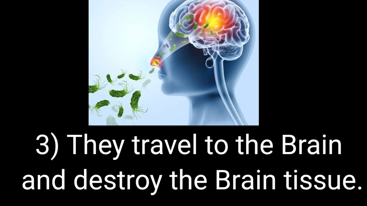 information about brain eating amoebas - YouTube