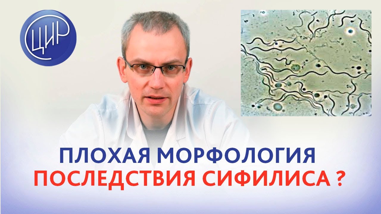 Нелеченный сифилис и морфология сперматозоидов 2%. Что делать? Врач ...