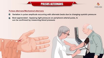 Pulses Alternans - Definition, Etiology and Mechanism : Internal medicine : #Usmle Cardiology