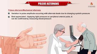 Pulses Alternans - Definition, Etiology and Mechanism : Internal medicine : #Usmle Cardiology