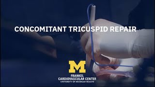 Cardiac Surgery Simplified: Concomitant Tricuspid Repair