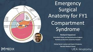 9 Compartment Syndrome Emergency Surgical Anatomy For Fy1