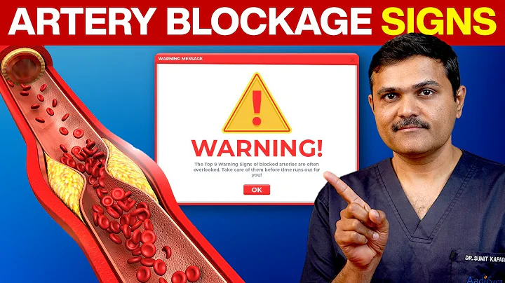 9 Shocking Signs You Have BLOCKED ARTERIES!