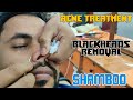 SHAMBOO💈Acne Treatment and Blackheads Removal with Face Cleaning💈MASTER ASMR💈#ASMR